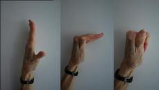 Лечебная физкультура: упражнения для пальцев рук, для кистей Лфк для запястья