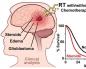 Treatment of tumor metastases to the brain