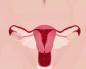 Zakaj med menstruacijo ni krvavitve
