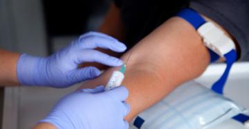 Алергични кожни тестове Какво представляват кожни тестове за алергии?