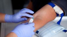 Алергични кожни тестове Какво представляват кожни тестове за алергии?