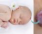 Hemangiom pri novorojenčku: vzroki, zdravljenje in odstranitev Kako se zdravi hemangiom pri nedonošenčku