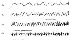 Tehnika elektroencefalografije Osnove EEG-a za početnike