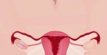 Zakaj krvavim izven menstruacije?