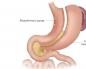 Kaj je gastrektomija in kako poteka operacija? Prehrana, prehrana po gastrektomiji