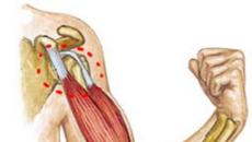 Treatment of injury to the biceps brachii