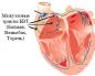 système de conduction du coeur