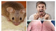 Mišja groznica kod odraslih: putevi infekcije, simptomi, stadiji